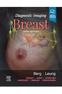 E-book Diagnostic Imaging: Breast