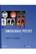 E-book Fundamentals Of Oncologic Pet/Ct