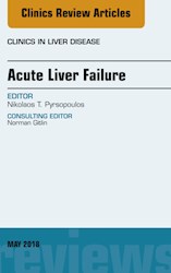 E-book Acute Liver Failure, An Issue Of Clinics In Liver Disease