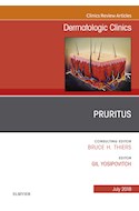 E-book Pruritus, An Issue Of Dermatologic Clinics