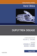 E-book Dupuytren Disease, An Issue Of Hand Clinics