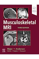 E-book Musculoskeletal Mri