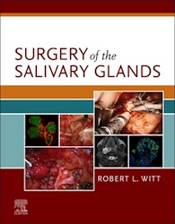E-book Surgery Of The Salivary Glands E-Book
