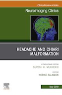 E-book Headache And Chiari Malformation, An Issue Of Neuroimaging Clinics Of North America