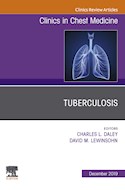 E-book Tuberculosis, An Issue Of Clinics In Chest Medicine