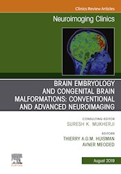 E-book Brain Embryology And The Cause Of Congenital Malformations, An Issue Of Neuroimaging Clinics Of North America