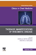 E-book Thoracic Manifestations Of Rheumatic Disease, An Issue Of Clinics In Chest Medicine