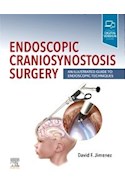 Papel Endoscopic Craniosynostosis Surgery