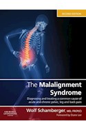 E-book The Malalignment Syndrome