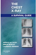 E-book The Chest X-Ray: A Survival Guide