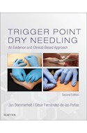 E-book Trigger Point Dry Needling