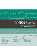 E-book 150 Ecg Cases