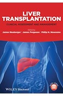 Papel Liver Transplantation: Clinical Assessment And Management
