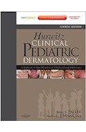 Papel Hurwitz Clinical Pediatric Dermatology: A Textbook Of Skin Disorders Of Childhood And Adolescence