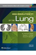 Papel High-Resolution Ct Of The Lung