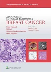 Papel Advances In Surgical Pathology: Breast Cancer
