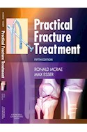 E-book Practical Fracture Treatment