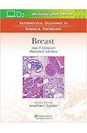 Papel Differential Diagnoses In Surgical Pathology: Breast