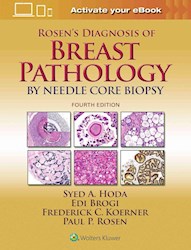 Papel Rosen S Diagnosis Of Breast Pathology By Needle Core Biopsy Ed.4