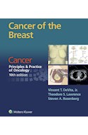 E-book Cancer Of The Breast