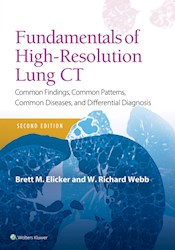 E-book Fundamentals Of High-Resolution Lung Ct