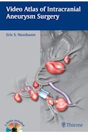 Papel Video Atlas Of Intracranial Aneurysm Surgery
