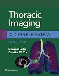 E-book Thoracic Imaging: A Core Review