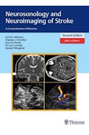 Papel Neurosonology And Neuroimaging Of Stroke Ed.2