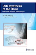 Papel Osteosynthesis Of The Hand
