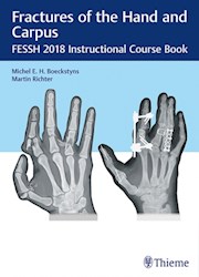 Papel Fractures Of The Hand And Carpus: Fessh 2018 Instructional Course Book