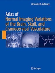Papel Atlas Of Normal Imaging Variations Of The Brain, Skull, And Craniocervical Vasculature