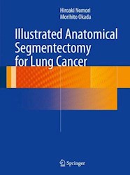 Papel Illustrated Anatomical Segmentectomy For Lung Cancer