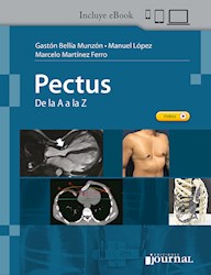 E-book Pectus De La A A La Z (Ebook)