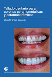 Libro Tallado Dentario Para Coronas Ceramometalicas Y C