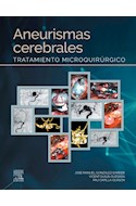 E-book Aneurismas Cerebrales