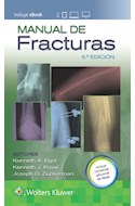 E-book Manual De Fracturas Ed.6 (Ebook)
