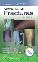 E-book Manual De Fracturas Ed.6 (Ebook)