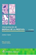 Papel Interpretación De Biopsias De La Próstata Ed.6