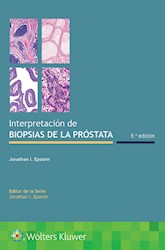 E-book Interpretación De Biopsias De La Próstata