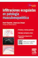 Papel Infiltraciones Ecoguiadas En Patología Musculoesquelética