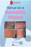 Papel Manual De La Dermatitis Atópica