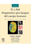 E-book Tc Y Rm. Diagnóstico Por Imagen Del Cuerpo Humano (2 Vol. Set) Ed.5 (Ebook)