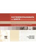 E-book Electroencefalografía Del Adulto