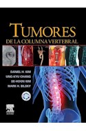 E-book Tumores De La Columna Vertebral
