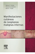 E-book Manifestaciones Cutáneas De Neoplasias Malignas Internas