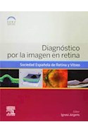 Papel Diagnóstico Por La Imagen En Retina