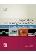 E-book Diagnóstico Por La Imagen En Retina