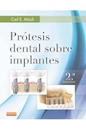 E-book Prótesis Dental Sobre Implantes