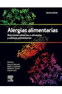 E-book Alergias Alimentarias. Reacciones Adversas A Alimentos Y Aditivos Alimentarios