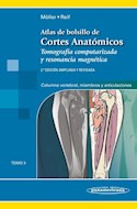 Papel Atlas De Bolsillo De Cortes Anatómicos. Tomo 3: Columna Vertebral, Extremidades Y Artic. Ed.4